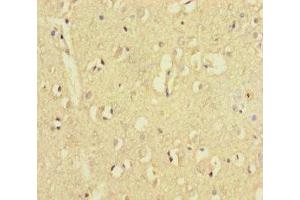 Immunohistochemistry of paraffin-embedded human brain tissue using ABIN7176535 at dilution of 1:100 (ZNF8 Antikörper  (AA 1-300))