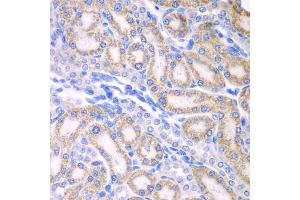 Immunohistochemistry of paraffin-embedded rat kidney using ALDH1A2 antibody (ABIN5975580) at dilution of 1/100 (40x lens).