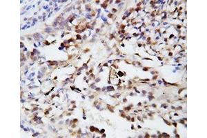 Immunohistochemistry (IHC) image for anti-Ubiquitin (Ub) (AA 29-45) antibody (ABIN3029417)