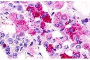 Image no. 1 for anti-G Protein-Coupled Receptor 12 (GPR12) (C-Term) antibody (ABIN1048702) (G Protein-Coupled Receptor 12 Antikörper  (C-Term))