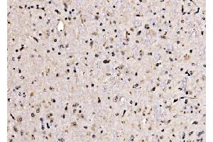 IHC analysis of KLF15 using anti-KLF15 antibody (ABIN7599269). (KLF15 Antikörper  (AA 1-323))