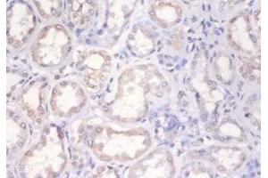 Immunohistochemistry of paraffin-embedded human kidney tissue using ABIN7155387 at dilution of 1:100 (H2AFX Antikörper  (AA 12-141))