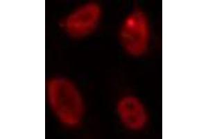 ABIN6274260 staining HepG2 cells by IF/ICC. (ID4 Antikörper  (N-Term))