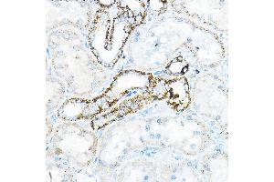 Immunohistochemistry of paraffin-embedded mouse kidney using BC Rabbit pAb (ABIN6131008, ABIN6137483, ABIN6137484 and ABIN6223295) at dilution of 1:100 (40x lens). (BCAT2 Antikörper  (AA 20-200))