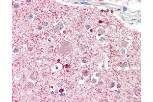 Anti-DGKQ antibody IHC staining of human brain, cortex. (DGKQ Antikörper  (AA 295-298))
