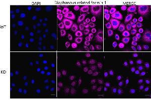 Immunocytochemical staining of HeLa cells using Diaphanous related formin 1 antibody (ABIN7798330), 1:1,000), Top panel: wild-type (WT), Bottom panal: Diaphanous related formin 1 shRNA knockdown (KD). (Rekombinanter DIAPH1 Antikörper)