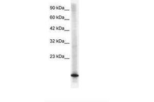 Image no. 1 for anti-Cyclin-Dependent Kinase Inhibitor 2B (p15, Inhibits CDK4) (CDKN2B) (C-Term) antibody (ABIN6735853) (CDKN2B Antikörper  (C-Term))