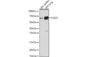 Western blot analysis of extracts of various cell lines, using CD25 antibody (ABIN3017118, ABIN3017119, ABIN3017120 and ABIN6219963) at 1:1000 dilution. (CD25 Antikörper)