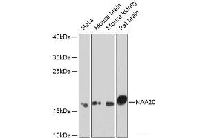 Western blot analysis of extracts of various cell lines using NAA20 Polyclonal Antibody at dilution of 1:1000. (NAT5 Antikörper)