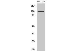 Western Blotting (WB) image for anti-Tripartite Motif Containing 24 (TRIM24) (C-Term) antibody (ABIN3187264) (TRIM24 Antikörper  (C-Term))