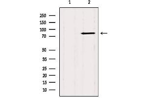 Western blot analysis of extracts from Mouse brain, using CTNNAL1 Antibody.