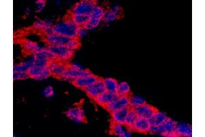 anti-Cancer Susceptibility Candidate 3 (CASC3) (AA 653-703) antibody