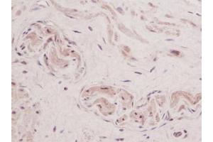 Image no. 1 for anti-Thymic Stromal Lymphopoietin (TSLP) antibody (ABIN465620) (Thymic Stromal Lymphopoietin Antikörper)
