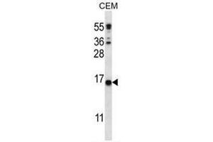 CJ057 Antibody (C-term) western blot analysis in CEM cell line lysates (35µg/lane). (CJ057 Antikörper  (C-Term))