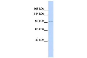 NDST3 antibody used at 1 ug/ml to detect target protein. (NDST3 Antikörper)