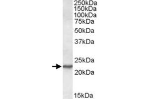 SAR1A polyclonal antibody  (0. (SAR1A Antikörper)