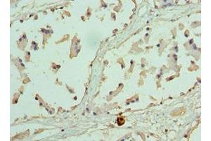 Immunohistochemistry of paraffin-embedded human prostate tissue using ABIN7155474 at dilution of 1:100 (EZH1 Antikörper  (AA 160-280))