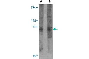 Western blot analysis of TMC8 in rat thymus tissue lysate with TMC8 polyclonal antibody  at (A) 1 and (B) 2 ug/mL . (TMC8 Antikörper  (N-Term))
