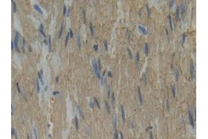 Used in DAB staining on fromalin fixed paraffin- embedded rectum tissue (Plastin 3 Antikörper  (AA 234-475))