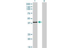 Western Blotting (WB) image for anti-Upstream Transcription Factor 2, C-Fos Interacting (USF2) (AA 1-100) antibody (ABIN563358)