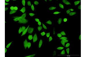 Immunofluorescence of purified MaxPab antibody to PSMD10 on HeLa cell. (PSMD10 Antikörper  (AA 1-226))