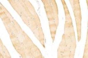 Immunohistochemistry analysis of paraffin-embedded rat skeletal muscle using,alpha Actinin (ABIN7073023) at dilution of 1: 500