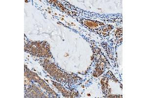 IHC analysis of SFXN3 using anti-SFXN3 antibody (ABIN7601302). (SFXN3 Antikörper  (AA 32-321))
