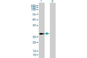 Western Blot analysis of SPANXN2 expression in transfected 293T cell line by SPANXN2 MaxPab polyclonal antibody. (SPANXN2 Antikörper  (AA 1-180))