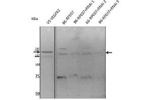 Anti-VEGFR2 antibody at 1/500 dlution, rabbit palyclonal to goat lgG (HRP), at 1/10,000 dilution, (VEGFR2/CD309 Antikörper  (AA 20-125))