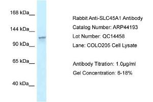 WB Suggested Anti-SLC45A1 Antibody   Titration: 1. (SLC45A1 Antikörper  (N-Term))