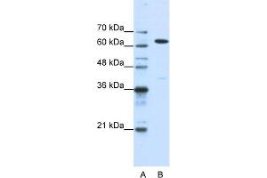 WB Suggested Anti-NXF1 Antibody Titration:  1. (NXF1 Antikörper  (N-Term))