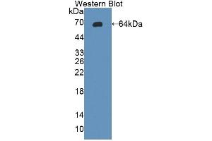 Detection of Recombinant gp130, Rat using Polyclonal Antibody to Glycoprotein 130 (gp130) (CD130/gp130 Antikörper  (AA 26-323))