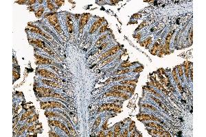ABIN7094449 and ABIN7098497 at 1/100 staining Rat colorectal tissue by IHC-P.