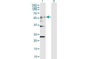 Western Blot analysis of CHRNA4 expression in transfected 293T cell line by CHRNA4 MaxPab polyclonal antibody. (CHRNA4 Antikörper  (AA 1-451))
