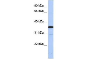ESD antibody used at 1 ug/ml to detect target protein. (Esterase D Antikörper  (N-Term))