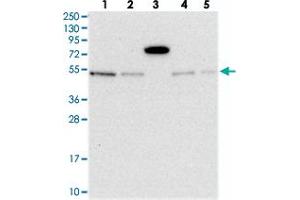 Western blot analysis of Lane 1: RT-4, Lane 2: U-251 MG, Lane 3: Human Plasma, Lane 4: Liver, Lane 5: Tonsil with MSANTD2 polyclonal antibody  at 1:250-1:500 dilution. (MSANTD2 Antikörper)