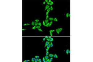 Immunofluorescence analysis of HeLa cells using CES2 Polyclonal Antibody (CES2 Antikörper)