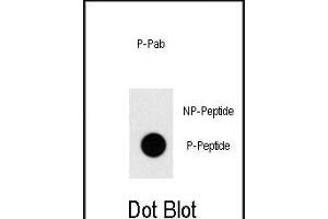 Dot blot analysis of anti-Phospho-TAL1-pT90 Pab (ABIN650830 and ABIN2839799) on nitrocellulose membrane. (TAL1 Antikörper  (pThr90))