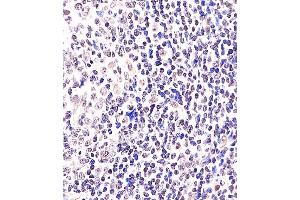 (ABIN6243067 and ABIN6578362) staining BCL6 in Human tonsil tissue sections by Immunohistochemistry (IHC-P - paraformaldehyde-fixed, paraffin-embedded sections). (BCL6 Antikörper  (AA 364-395))