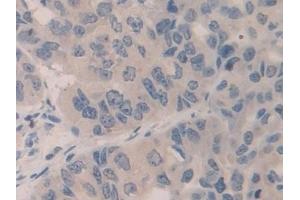 Immunohistochemistry (IHC) image for anti-Structural Maintenance of Chromosomes 3 (SMC3) (AA 994-1181) antibody (ABIN7440092)