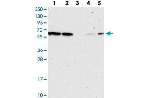 Western blot analysis of Lane 1: RT-4, Lane 2: U-251 MG, Lane 3: Human Plasma, Lane 4: Liver, Lane 5: Tonsil with NAE1 polyclonal antibody . (NAE1 Antikörper)