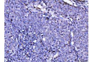 IHC analysis of RAE1 using anti-RAE1 antibody (ABIN7602428). (RAE1 Antikörper  (AA 76-368))