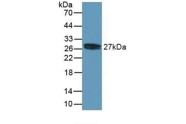 MYL4 Antikörper  (AA 6-191)