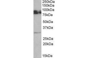 AP23233PU-N GPM6A antibody staining of Rat Brain lysate at 0. (GPM6A Antikörper  (Internal Region))
