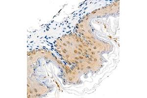 Immunohistochemistry of paraffin embedded mouse stomach using COPS2 (ABIN7073324) at dilution of 1:1400 (400x lens)