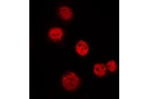 ABIN6275288 staining Hela by IF/ICC. (N4BP1 Antikörper  (Internal Region))
