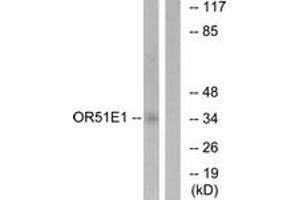 Western blot analysis of extracts from HeLa cells, using OR51E1 Antibody. (OR51E1 Antikörper  (AA 241-290))