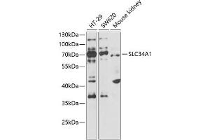 Western blot analysis of extracts of various cell lines, using SLC34 antibody  at 1:1000 dilution. (Solute Carrier Family 34 (Type II Sodium/phosphate Contransporter), Member 1 (SLC34A1) Antikörper)