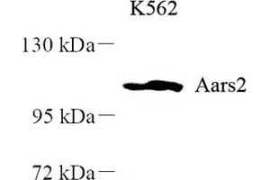 Western blot analysis of AARS2 (ABIN7072990),at dilution of 1: 500 (AARS2 Antikörper)