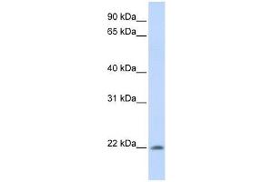 Western Blot showing C2orf28 antibody used at a concentration of 1-2 ug/ml to detect its target protein. (ATRAID Antikörper  (C-Term))
